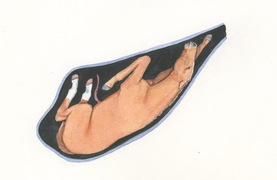 Abnormal presentation of foal in the uterus.