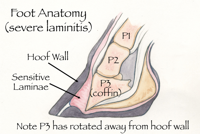 Illustration of horse's foot revealing a case of severe laminitis.