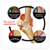 Cycle of Osteeroarthritis in horse's joint