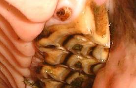 A small wolf tooth set close to the 2nd premolar on the palatal aspect in a horse.