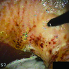 Image of a grade 3 ulcer in horse's stomach.