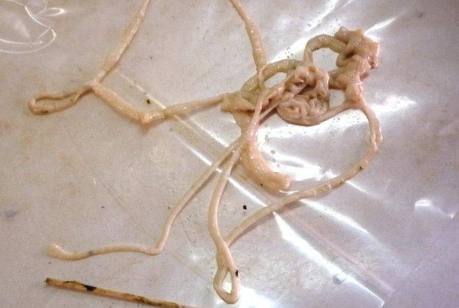 Specimen tapeworm for research study.