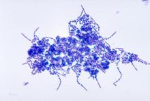 Dermatophilus congolensis - Cause of dermatitis in horses